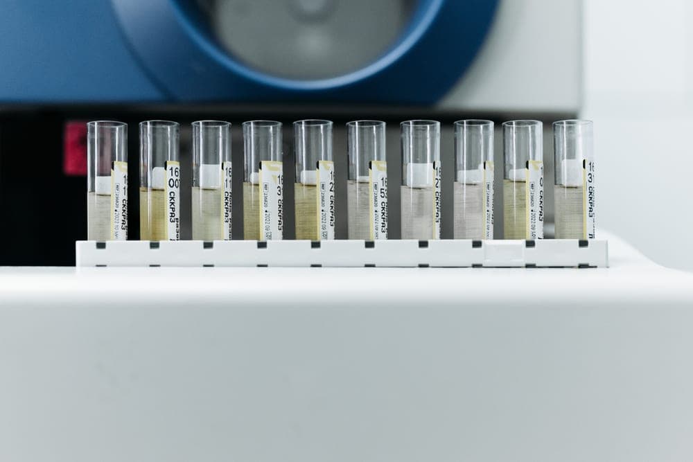 A chemical test strip being compared against a color chart